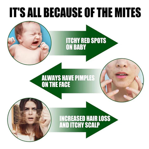 Green Prickly Ash Herbal Mite Remover